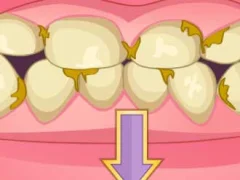 Logħba Bad Teeth Makeover onlajn