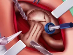 Logħba Princess Hips Surgery onlajn