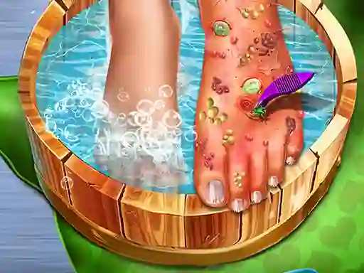Logħba Feet Skin Doctor onlajn