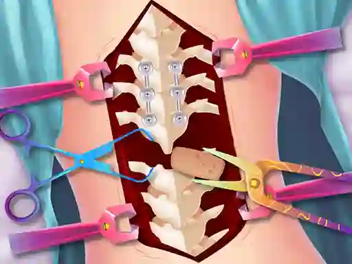 Logħba Anna Scoliosis Surgery onlajn